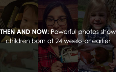 Amazing Photos Show Before and After Pictures of Premature Babies Born Before 24 Weeks