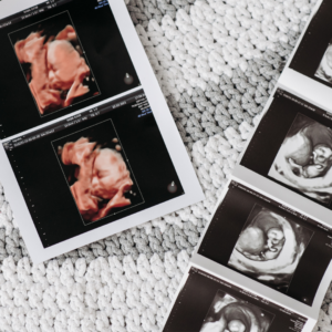 Abortion ultrasound