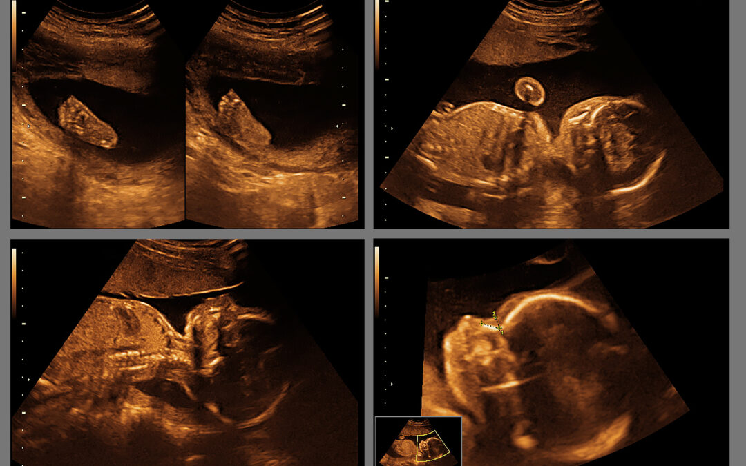 Planned Parenthood Smears Baby Development Education in Schools